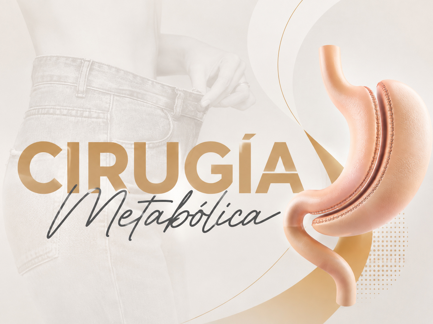 Ilustración anatómica de cirugía metabólica