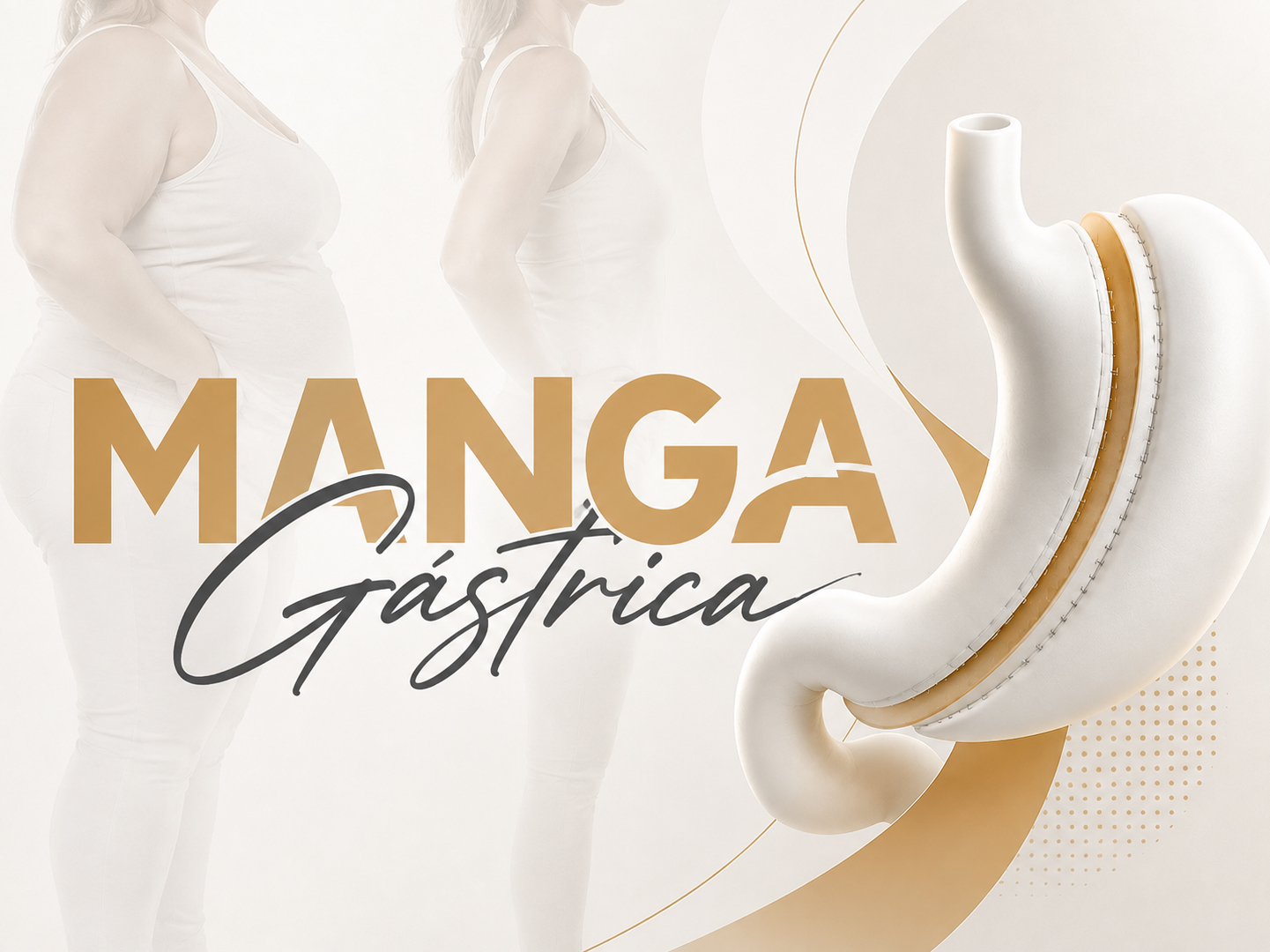 Ilustración anatómica de manga gástrica